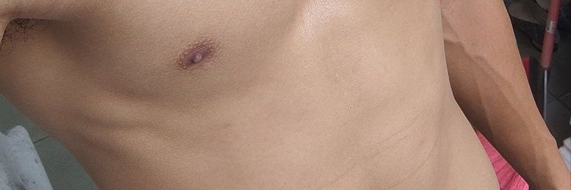 Gone. banner