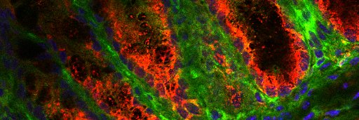 Blake Mitchell banner