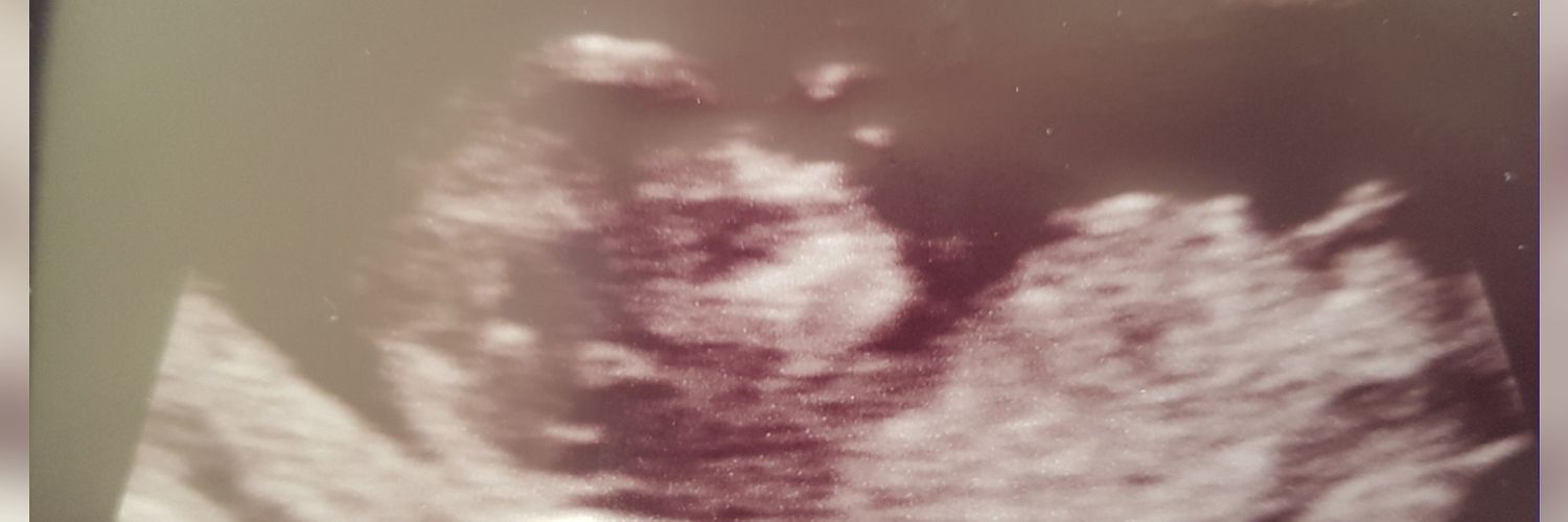 Elss1991's profile banner image
