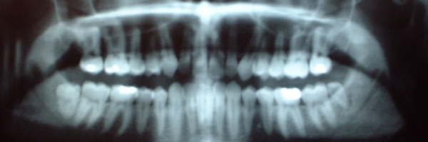 pickoo Profile Banner