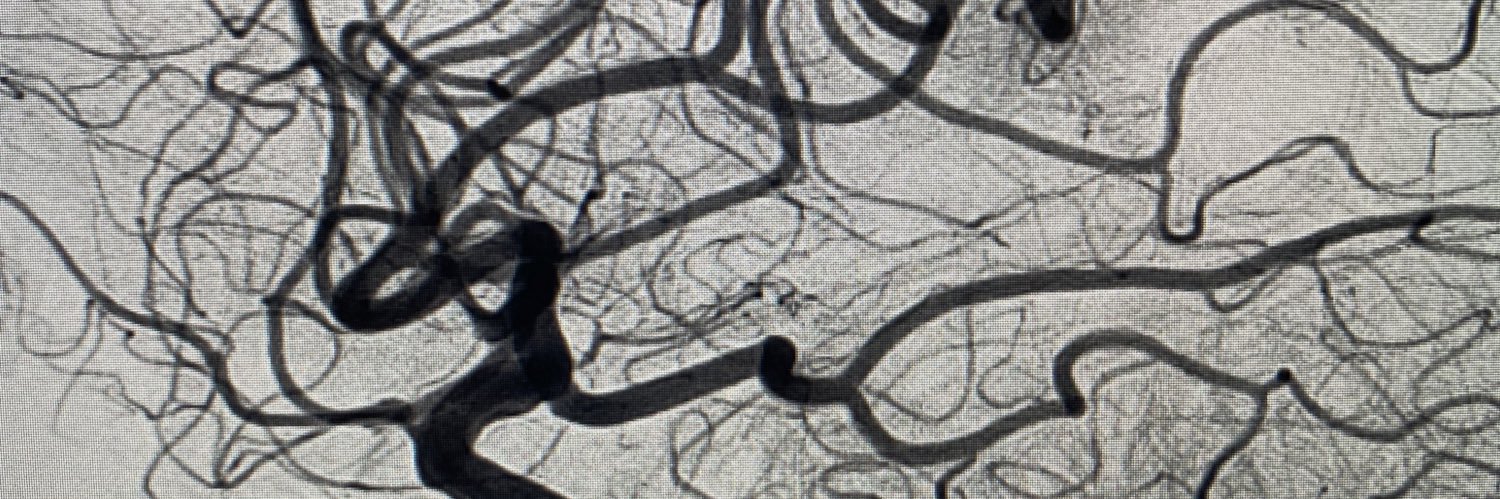 Canadian Interventional Neuro Group banner