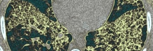 Kristopher Cummings, MD banner