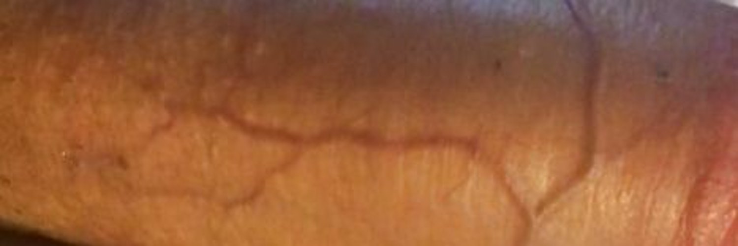 ̇ banner