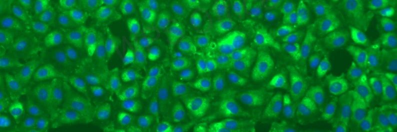 Ali Zohaib🇵🇸, DVM, MPVM , PhD ,🇸🇦🇵🇰🦇🇨🇳 banner