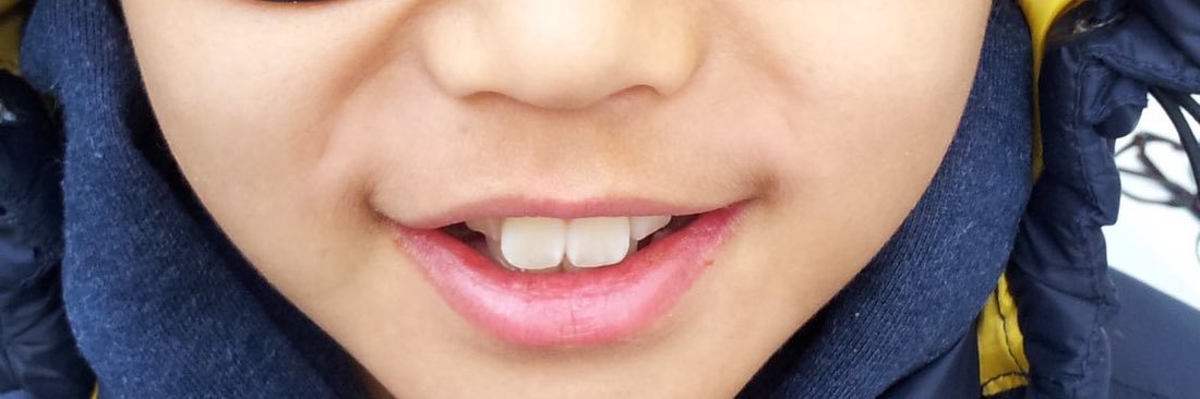 PP banner