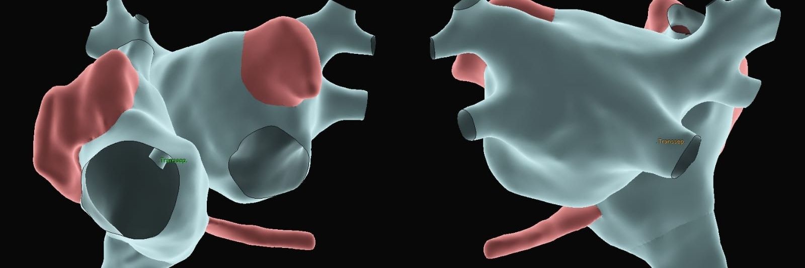 Thiago Mendes banner