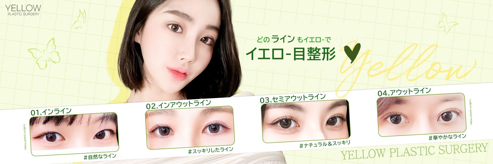 ■韓国整形■イエロー美容整形外科日本人公式エージェンシー banner