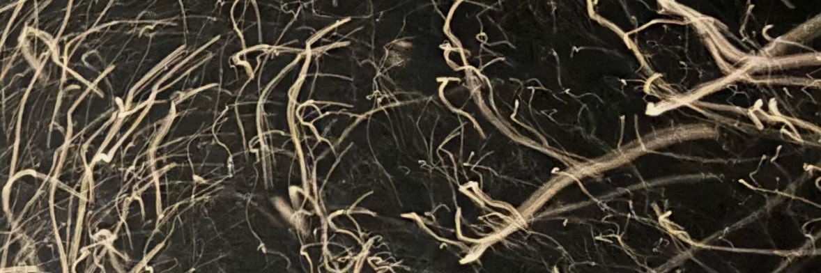 ☧ Bobby James banner