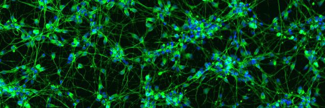 Antonietta Verrillo banner