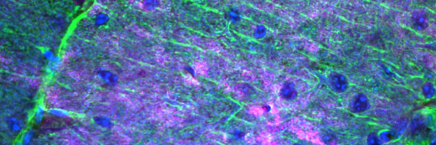 Synapse Biology Group | NCBio ERA Chair @i3S_Porto's banner