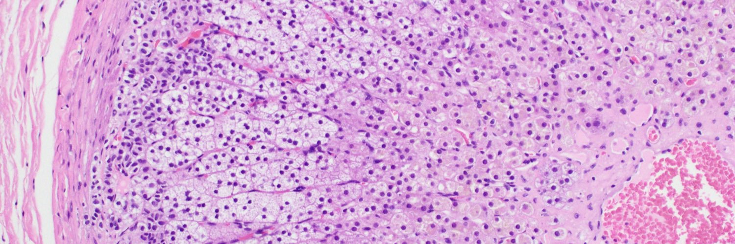 Albany Med Pathology banner