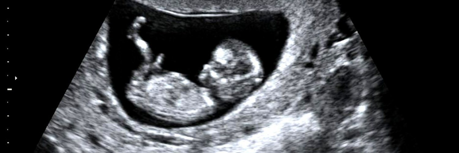 Chuck Swanson banner