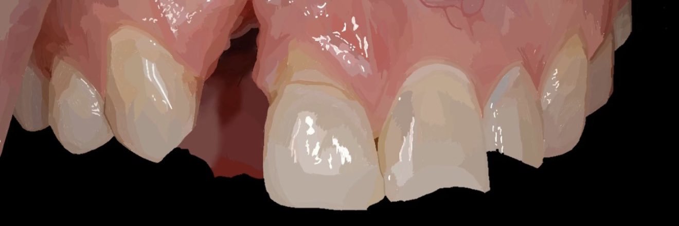 bloody xiyu 🔞 banner