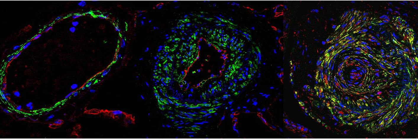 Guignabert’s Team banner