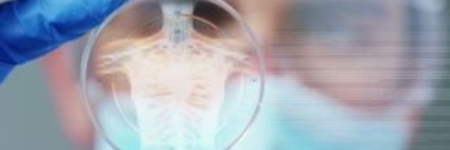 BEAT Severe Asthma Trial banner