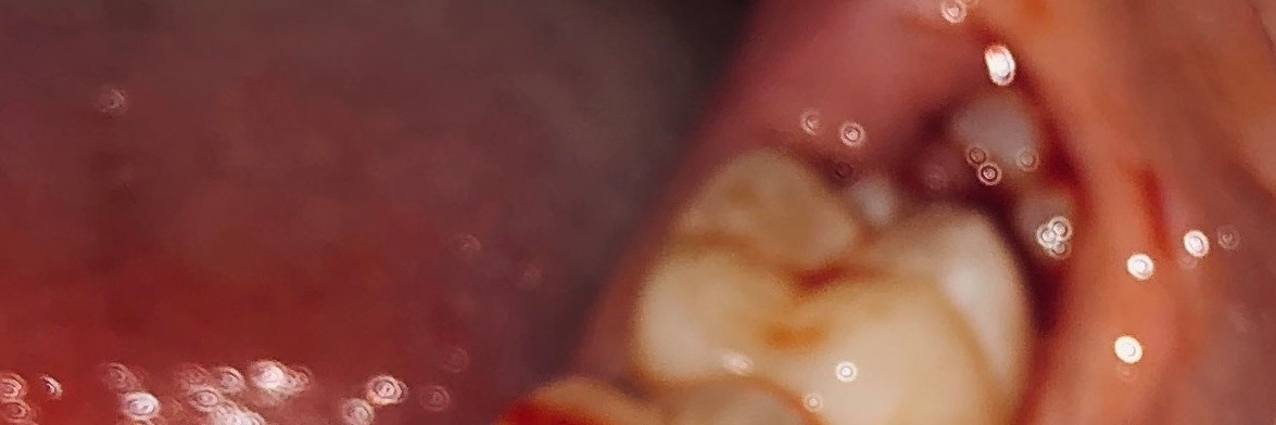 Le Butcherettes banner