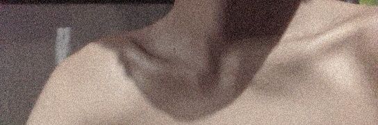 🅴 banner