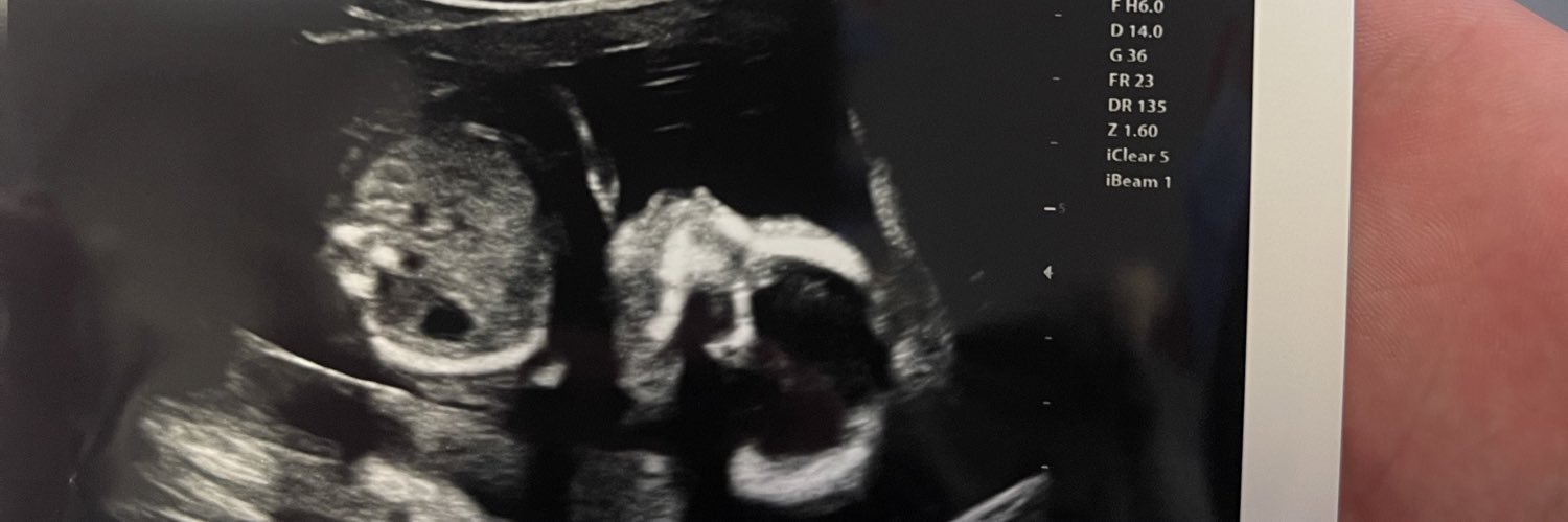 noemirodela2's profile banner image