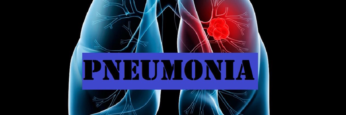 Pneumonia Nursing Team (S.P.I.N) banner