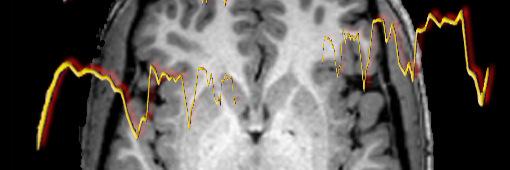 Dimitri Van De Ville banner