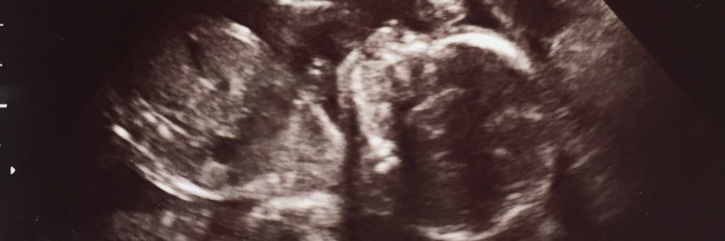 McKaelaR's profile banner image