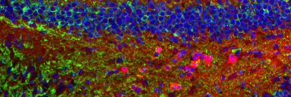 Tau Neurodiscovery banner