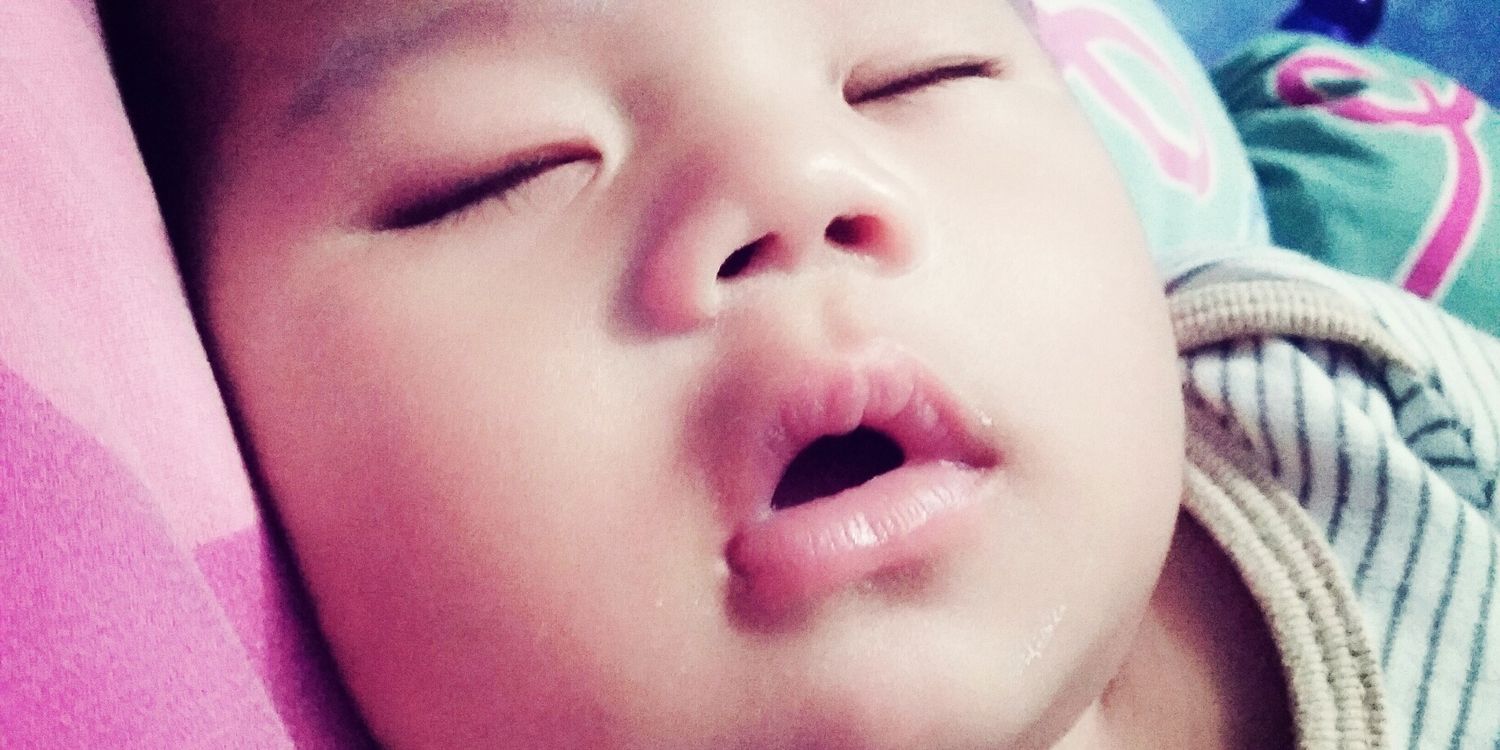 MEYLINDHAFARRAS banner