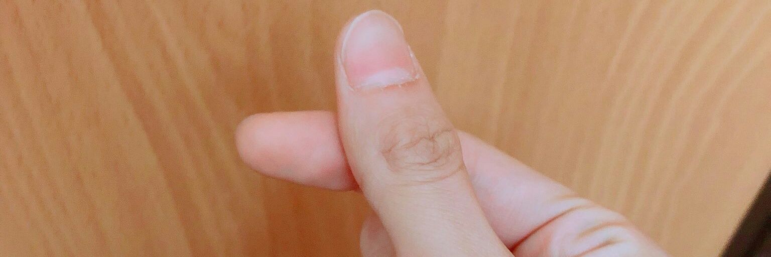 리미티드에디션 banner