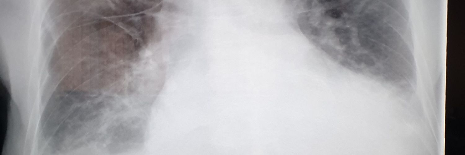 Michael Denkinger banner