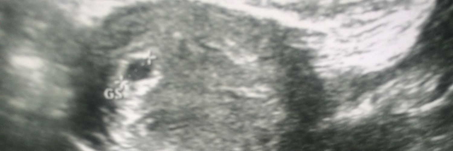 Re3ny77's profile banner image