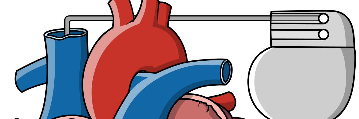 pacemakerplus's profile banner image