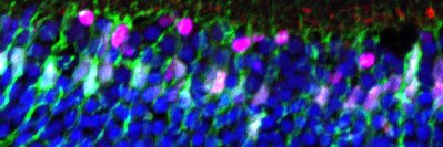 Steven Bergmans banner