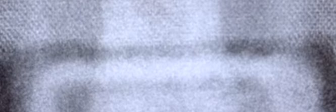 B banner