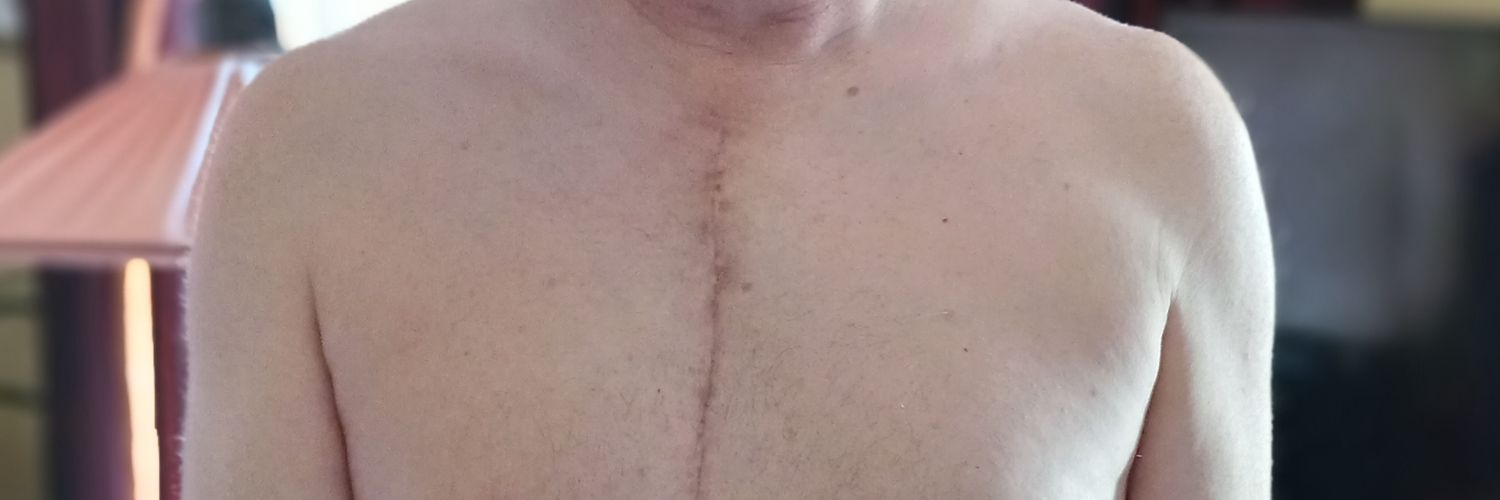 Stephen Nixon banner