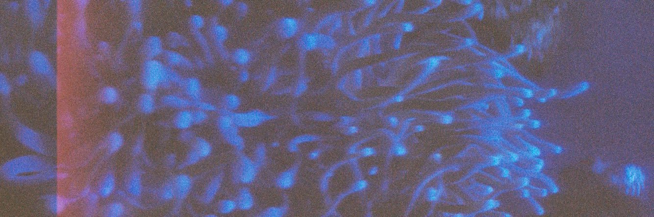 1000 banner