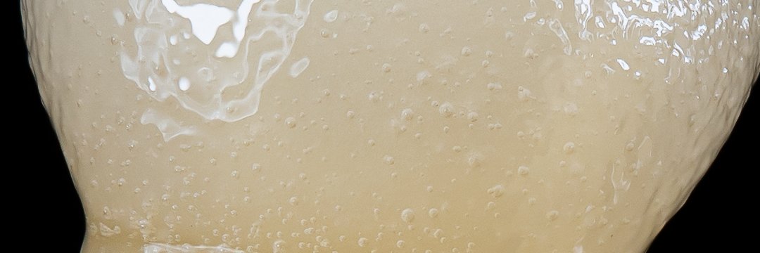 Select Phenotype banner