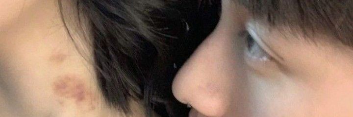 . banner