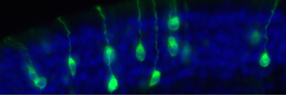 Steve Rodriguez banner