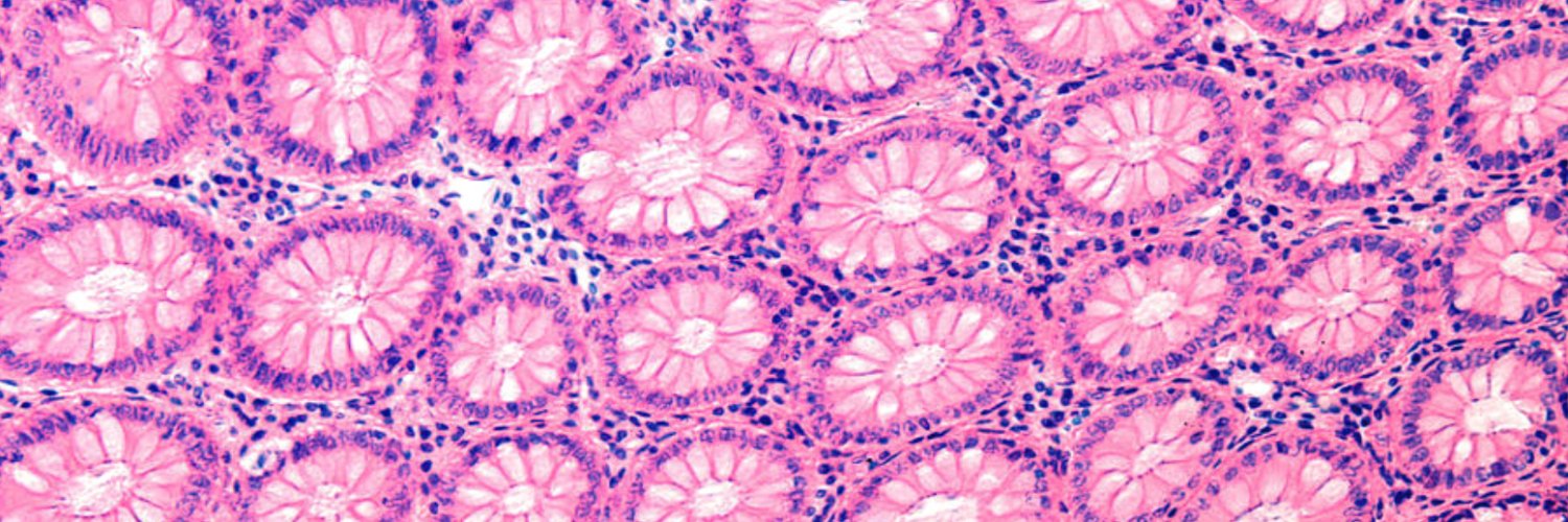 Veronica Martinez-Brockhus, MS banner