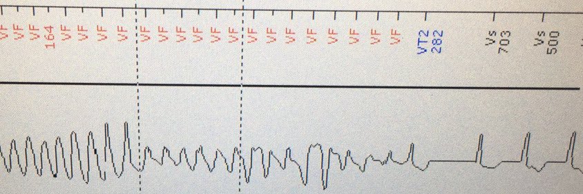 Bradley Pitman banner