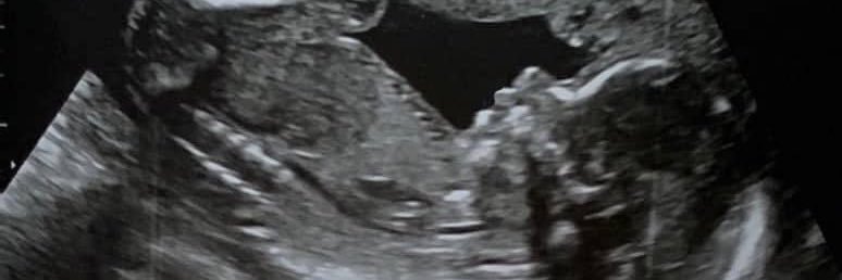 tleal19's profile banner image