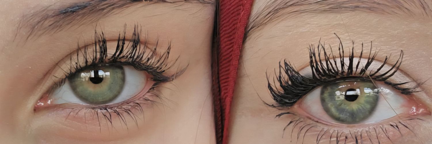 Öznurᥫ᭡ banner