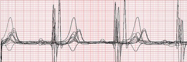 ECGNurse Profile Banner