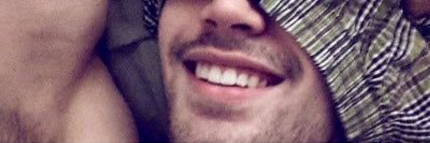 X banner