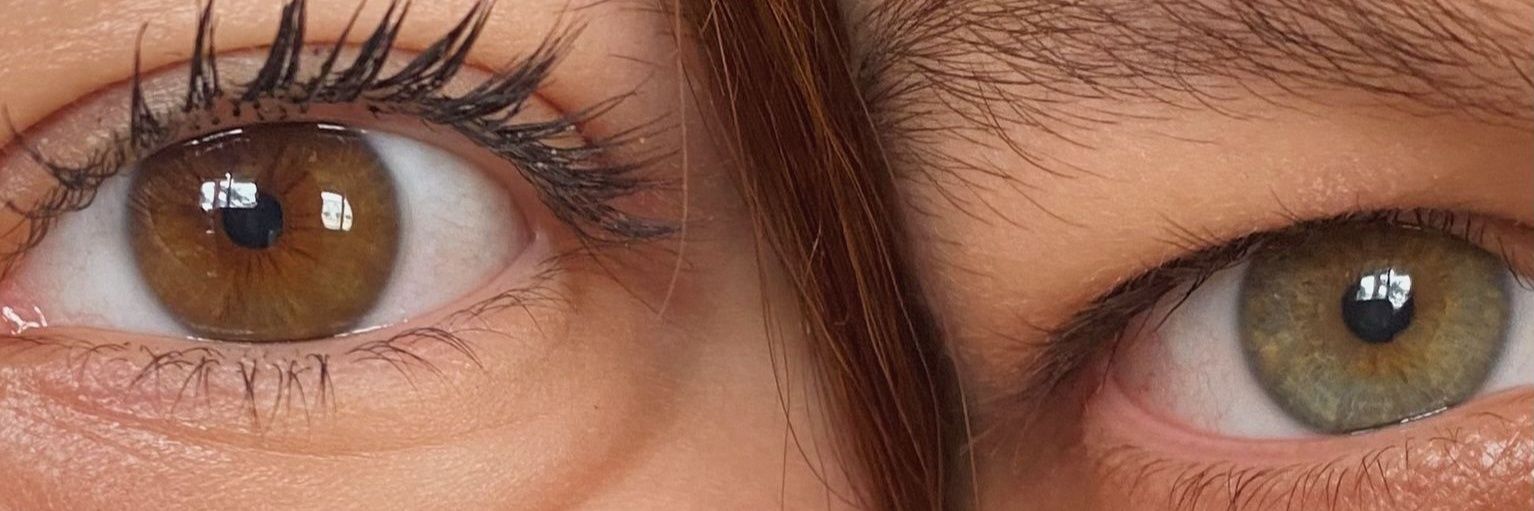 mert banner