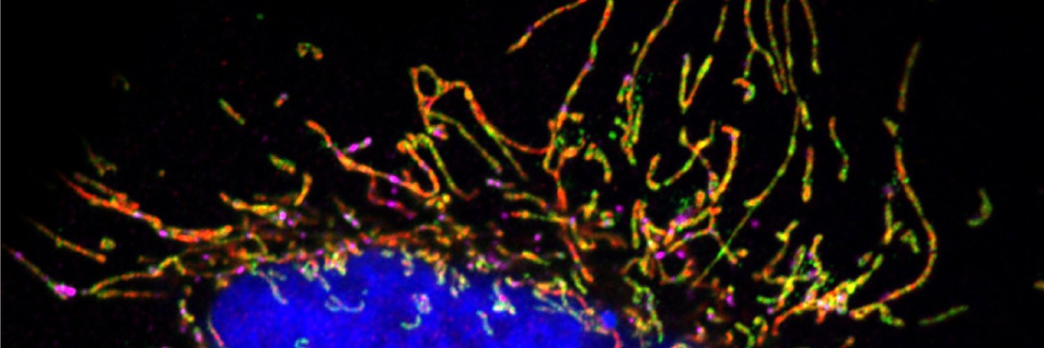 A. Phillip West banner