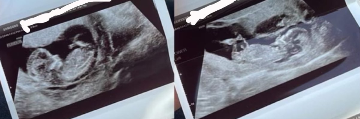 TwinDadDev's profile banner image