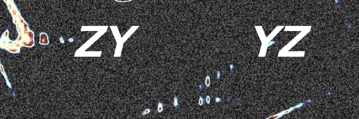 ZBOY. banner