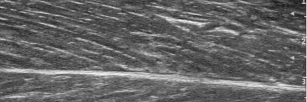 MVFranchi Profile Banner