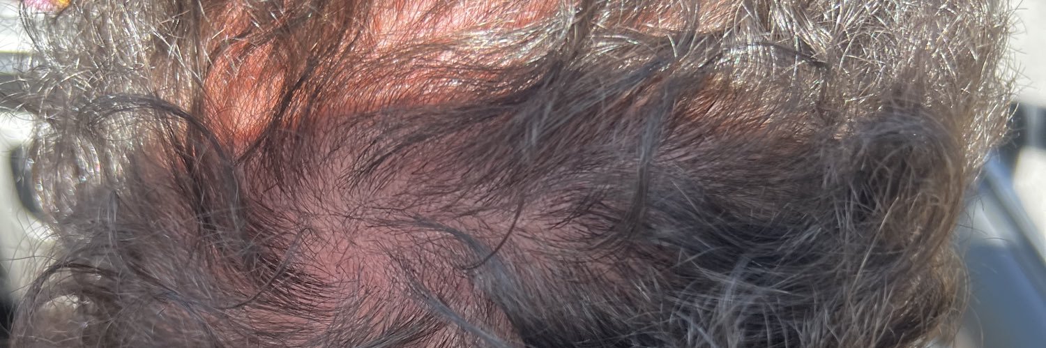 When Will The Suffering End? banner